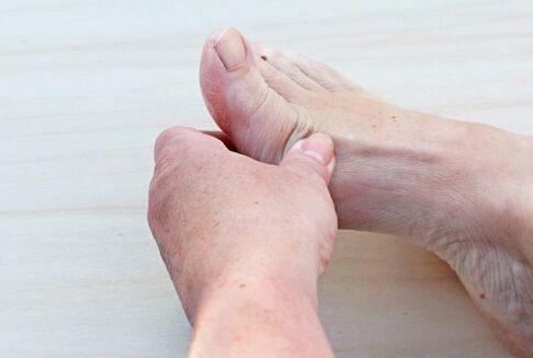 pēdas artroze