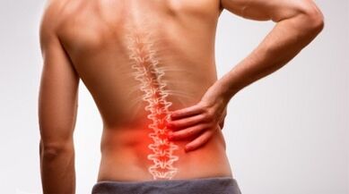 Jostas mugurkaula osteohondrozes pazīmes un simptomi