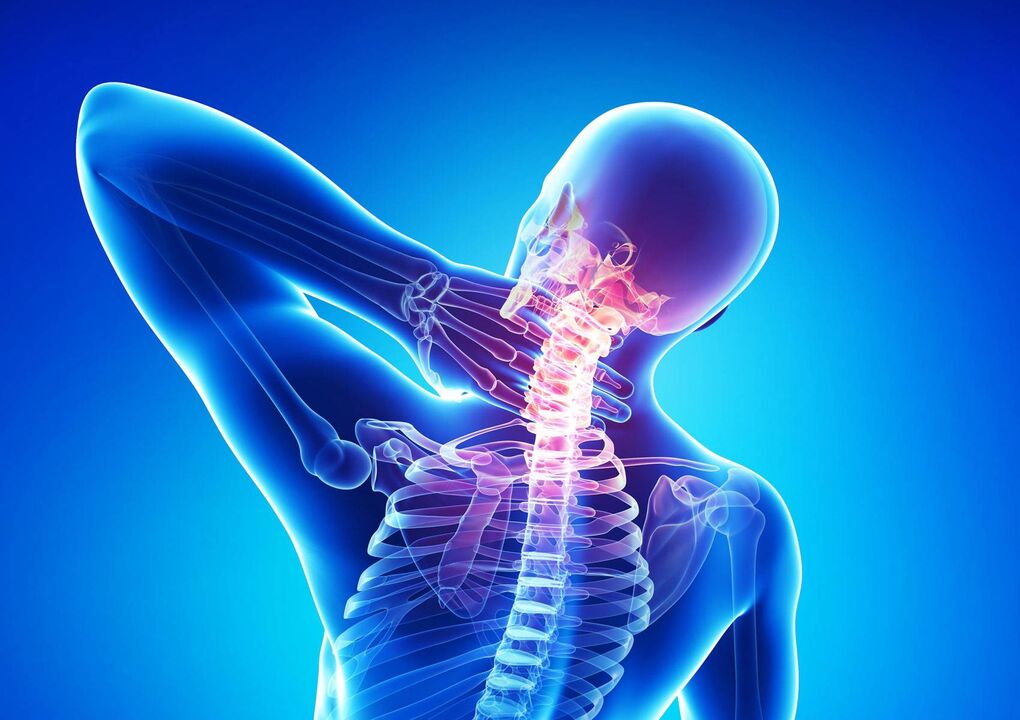 Kakla osteohondroze