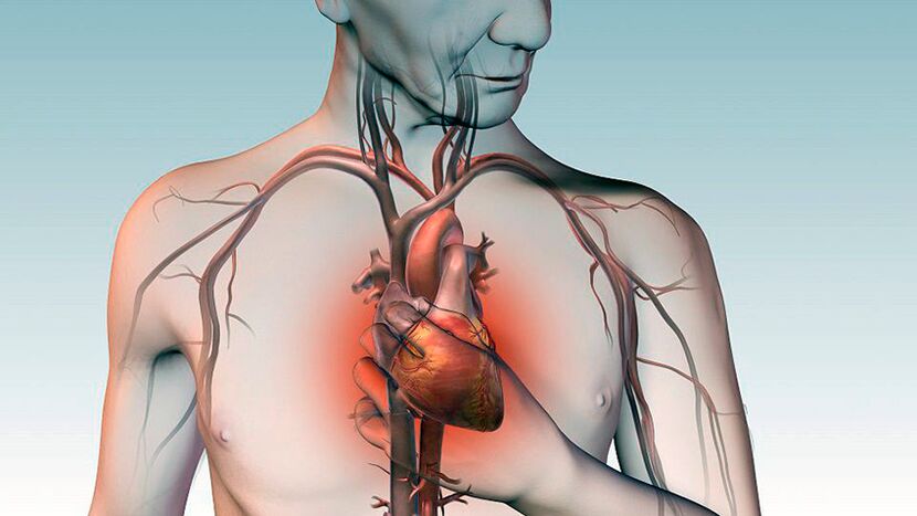 Sāpes zem lāpstiņas un spiedošas sāpes aiz krūšu kaula ar sirds slimībām